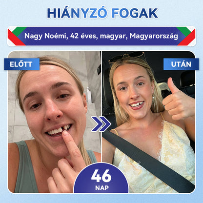 🦷𝐆𝐥𝐢𝐦𝐦𝐞𝐫𝐥𝐲® Tideglusib Fog & íny Javító mikrotűs tapasz | Fejlett őssejt-aktiváló fogcsíkok (újjáépíti a fogzománcot és a dentint • erősíti az ínyt • megszünteti a fogkövet és a szagokat • megállítja a fogérzékenységet))