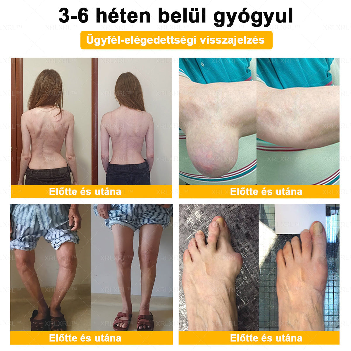 🎉🎉XRLXRL® Botulinum Toxin és Méhméreg Fájdalomcsillapító Csontgyógyító Krém (Speziell für ältere Erwachsene)