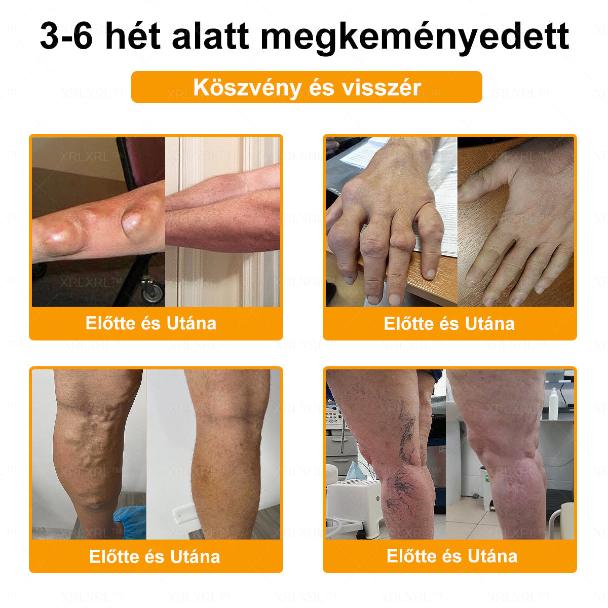 🎉🎉XRLXRL® Botulinum Toxin és Méhméreg Fájdalomcsillapító Csontgyógyító Krém (Speziell für ältere Erwachsene)