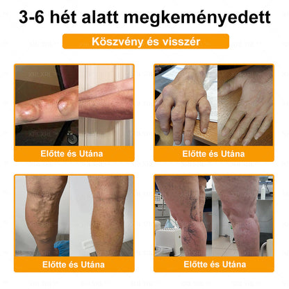 🎉🎉XRLXRL® Botulinum Toxin és Méhméreg Fájdalomcsillapító Csontgyógyító Krém (Speziell für ältere Erwachsene)