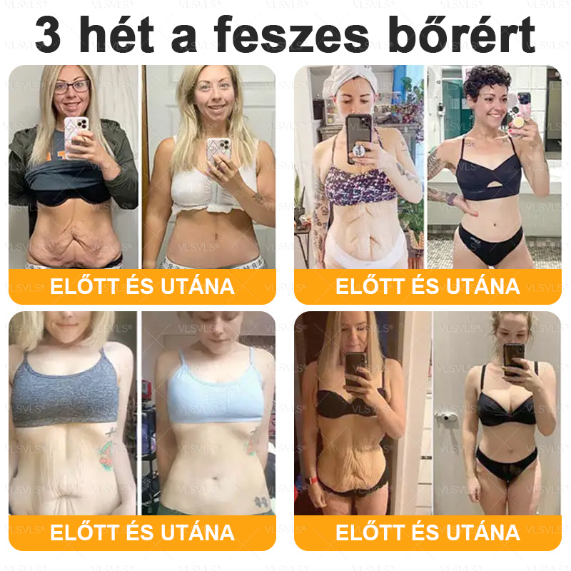 ✨✨✨VLSVLS® Méhméreg Átfogó Krém (Minden korosztály számára alkalmas )