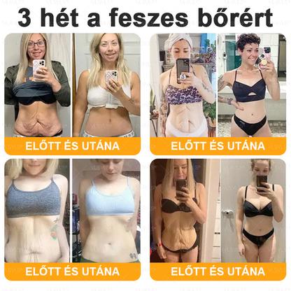 ✨✨✨VLSVLS® Méhméreg Átfogó Krém (Minden korosztály számára alkalmas )