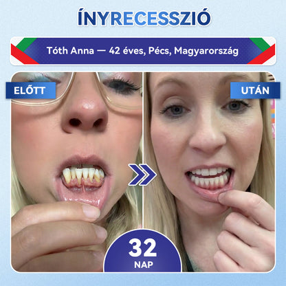 🦷𝐆𝐥𝐢𝐦𝐦𝐞𝐫𝐥𝐲® Tideglusib Fog & íny Javító mikrotűs tapasz | Fejlett őssejt-aktiváló fogcsíkok (újjáépíti a fogzománcot és a dentint • erősíti az ínyt • megszünteti a fogkövet és a szagokat • megállítja a fogérzékenységet))