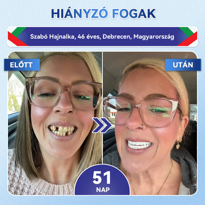 🦷𝐆𝐥𝐢𝐦𝐦𝐞𝐫𝐥𝐲® Tideglusib Fog & íny Javító mikrotűs tapasz | Fejlett őssejt-aktiváló fogcsíkok (újjáépíti a fogzománcot és a dentint • erősíti az ínyt • megszünteti a fogkövet és a szagokat • megállítja a fogérzékenységet))