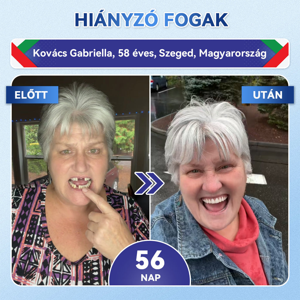 🦷𝐆𝐥𝐢𝐦𝐦𝐞𝐫𝐥𝐲® Tideglusib Fog & íny Javító mikrotűs tapasz | Fejlett őssejt-aktiváló fogcsíkok (újjáépíti a fogzománcot és a dentint • erősíti az ínyt • megszünteti a fogkövet és a szagokat • megállítja a fogérzékenységet))