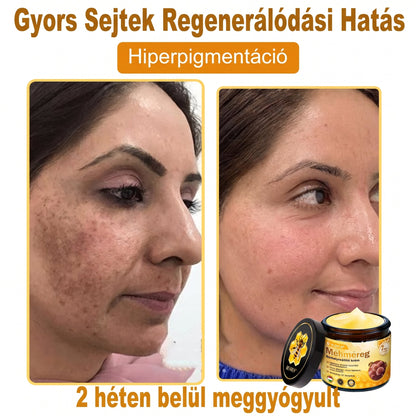 🔹 𝑽𝙇𝙎𝑽𝑳𝑺® Méhméreg Bőr Helyreállító Krém (🎉🎉CE Tanúsítvány)