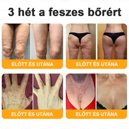 ✨✨✨VLSVLS® Méhméreg Átfogó Krém (Minden korosztály számára alkalmas )