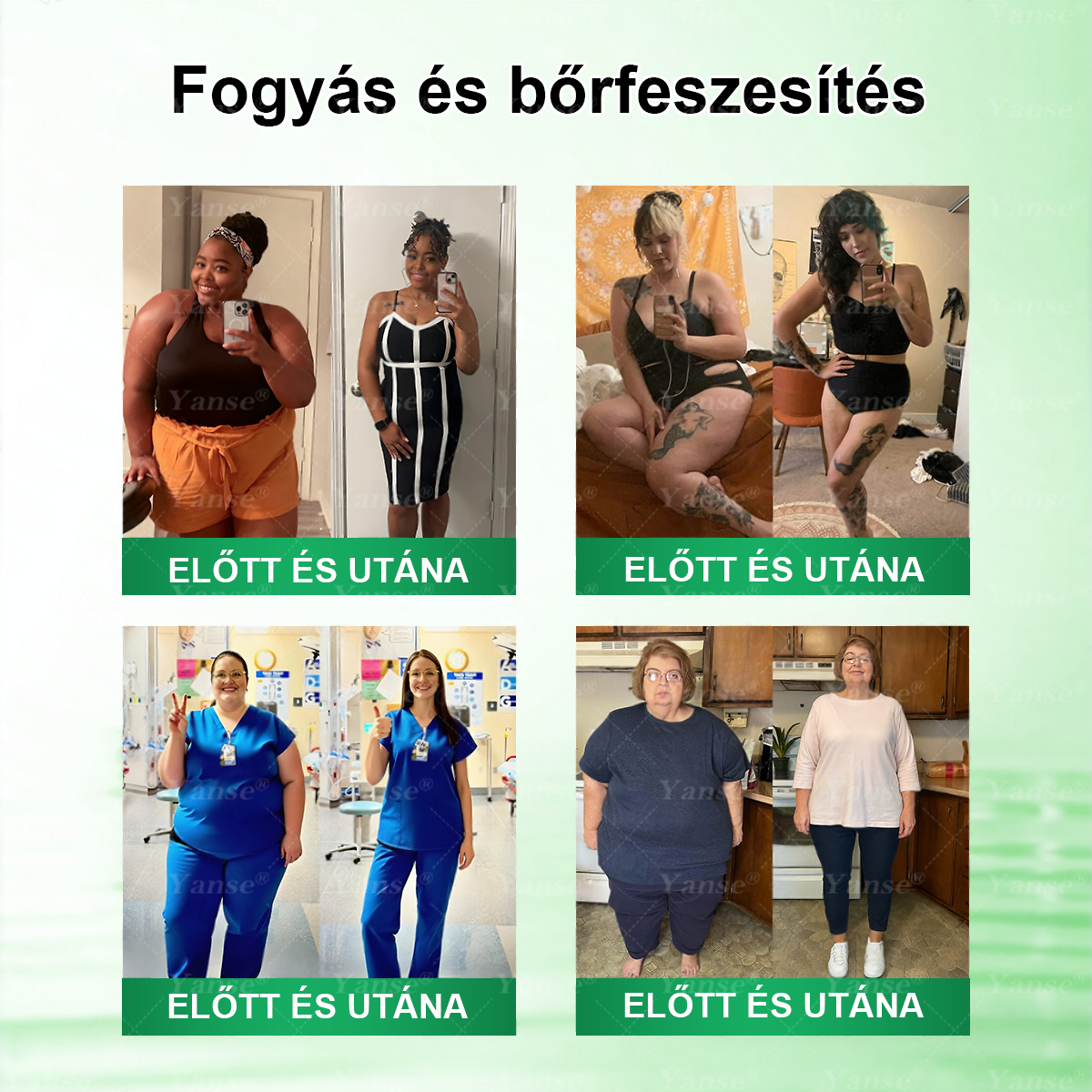 🇭🇺𝗛𝗶𝘃𝗮𝘁𝗮𝗹𝗼𝘀 Á𝗿𝘂𝗵á𝘇 | 🍀🍀𝐘𝐚𝐧𝐬𝐞® 𝗠𝗼𝗿𝗶𝗻𝗴𝗮·𝗕𝗲𝗿𝗯𝗲𝗿𝗶𝗻𝗲×𝗡𝗔𝗗+ 𝟭𝟬‑𝗶𝗻‑𝟭 𝗧𝗮𝗽𝗮𝘀𝘇 (𝗡𝗮𝗽𝗼𝗻𝘁𝗮 𝗲𝗴𝘆𝘀𝘇𝗲𝗿, 𝟳 𝗻𝗮𝗽 𝗮𝗹𝗮𝘁𝘁 𝗹á𝘁𝗵𝗮𝘁ó 𝘃á𝗹𝘁𝗼𝘇á𝘀)✅ 𝗘𝗹𝗵í𝘇á𝘀, 𝗹𝗮𝘇𝗮 𝗯ő𝗿, 𝗰𝘂𝗸𝗼𝗿𝗯𝗲𝘁𝗲𝗴𝘀é𝗴, 𝗮𝗹𝘃á𝘀𝗶 𝗮𝗽𝗻𝗼é, í𝘇ü𝗹𝗲𝘁𝗶 𝗽𝗿𝗼𝗯𝗹é𝗺á𝗸 𝗸𝗲𝘇𝗲𝗹é𝘀é𝗿𝗲