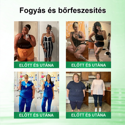 🇭🇺𝗛𝗶𝘃𝗮𝘁𝗮𝗹𝗼𝘀 Á𝗿𝘂𝗵á𝘇 | 🍀🍀𝐘𝐚𝐧𝐬𝐞® 𝗠𝗼𝗿𝗶𝗻𝗴𝗮·𝗕𝗲𝗿𝗯𝗲𝗿𝗶𝗻𝗲×𝗡𝗔𝗗+ 𝟭𝟬‑𝗶𝗻‑𝟭 𝗧𝗮𝗽𝗮𝘀𝘇 (𝗡𝗮𝗽𝗼𝗻𝘁𝗮 𝗲𝗴𝘆𝘀𝘇𝗲𝗿, 𝟳 𝗻𝗮𝗽 𝗮𝗹𝗮𝘁𝘁 𝗹á𝘁𝗵𝗮𝘁ó 𝘃á𝗹𝘁𝗼𝘇á𝘀)✅ 𝗘𝗹𝗵í𝘇á𝘀, 𝗹𝗮𝘇𝗮 𝗯ő𝗿, 𝗰𝘂𝗸𝗼𝗿𝗯𝗲𝘁𝗲𝗴𝘀é𝗴, 𝗮𝗹𝘃á𝘀𝗶 𝗮𝗽𝗻𝗼é, í𝘇ü𝗹𝗲𝘁𝗶 𝗽𝗿𝗼𝗯𝗹é𝗺á𝗸 𝗸𝗲𝘇𝗲𝗹é𝘀é𝗿𝗲