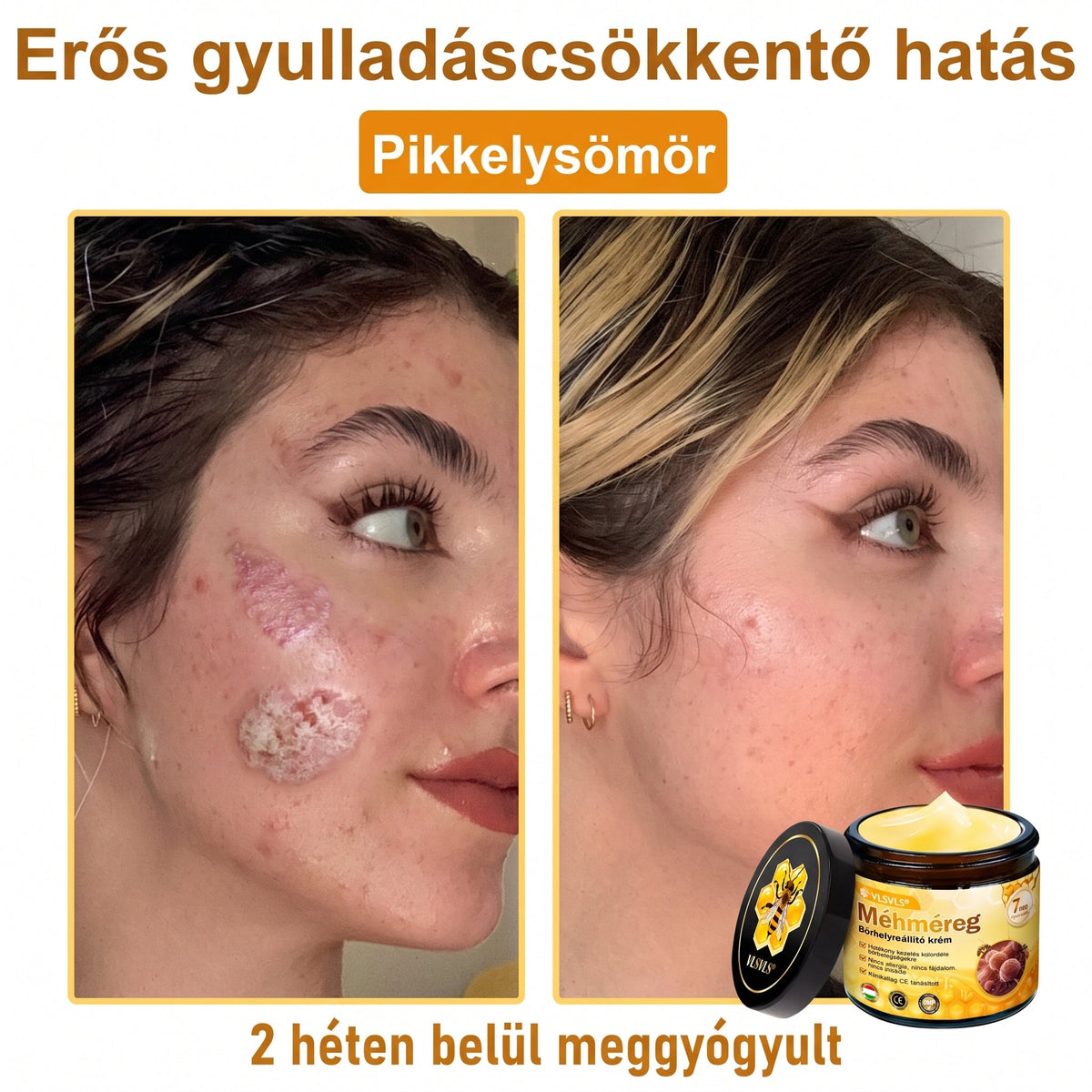 🔹 𝑽𝙇𝙎𝑽𝑳𝑺® Méhméreg Bőr Helyreállító Krém (🎉🎉CE Tanúsítvány)