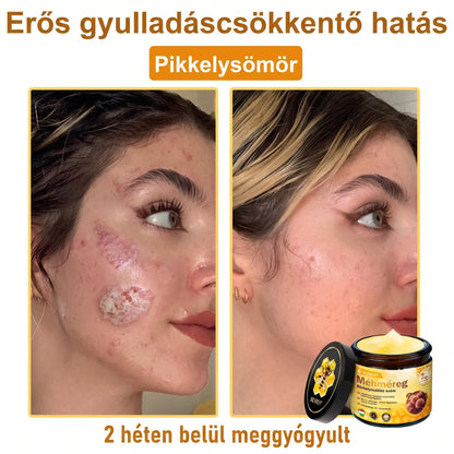 🔹 𝑽𝙇𝙎𝑽𝑳𝑺® Méhméreg Bőr Helyreállító Krém (🎉🎉CE Tanúsítvány)