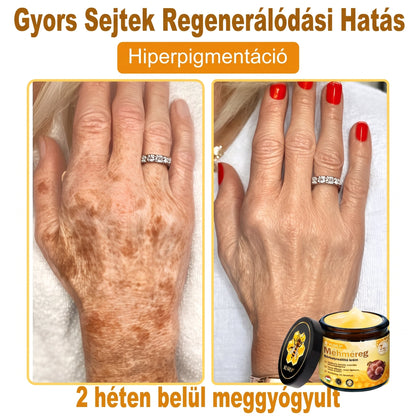🔹 𝑽𝙇𝙎𝑽𝑳𝑺® Méhméreg Bőr Helyreállító Krém (🎉🎉CE Tanúsítvány)