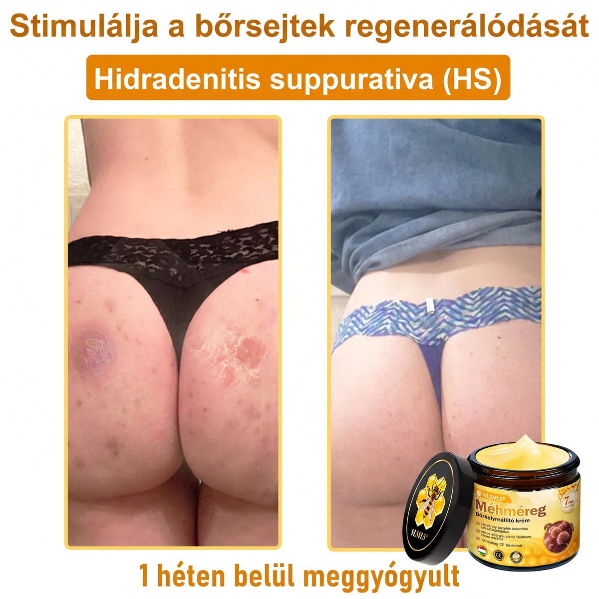 🔹 𝑽𝙇𝙎𝑽𝑳𝑺® Méhméreg Bőr Helyreállító Krém (🎉🎉CE Tanúsítvány)