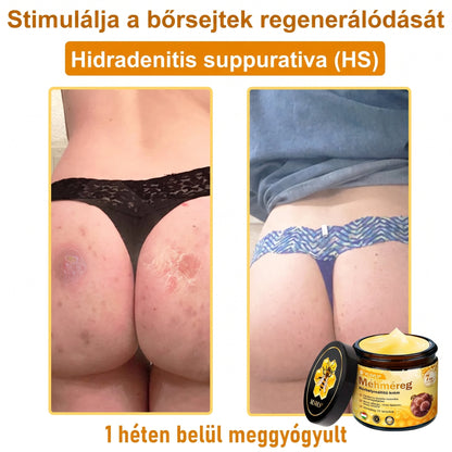 🔹 𝑽𝙇𝙎𝑽𝑳𝑺® Méhméreg Bőr Helyreállító Krém (🎉🎉CE Tanúsítvány)