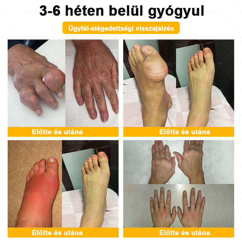 🎉🎉XRLXRL® Botulinum Toxin és Méhméreg Fájdalomcsillapító Csontgyógyító Krém (Speziell für ältere Erwachsene)
