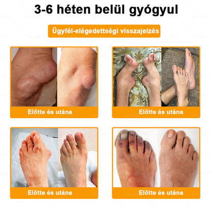 🎉🎉XRLXRL® Botulinum Toxin és Méhméreg Fájdalomcsillapító Csontgyógyító Krém (Speziell für ältere Erwachsene)