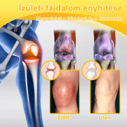 🎉🎉XRLXRL® Botulinum Toxin és Méhméreg Fájdalomcsillapító Csontgyógyító Krém (Speziell für ältere Erwachsene)