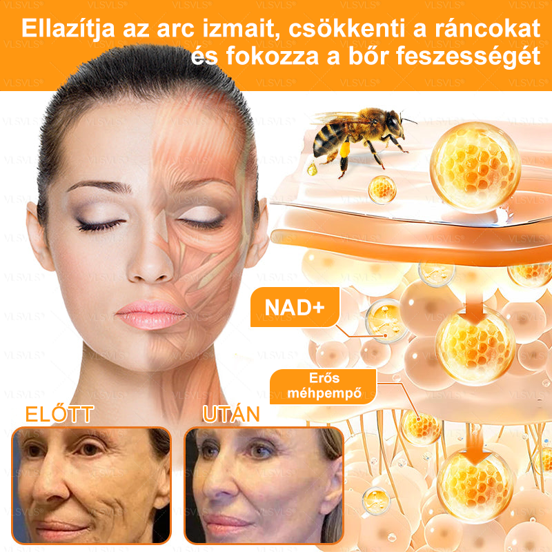✨✨✨VLSVLS® Méhméreg Átfogó Krém (Minden korosztály számára alkalmas )