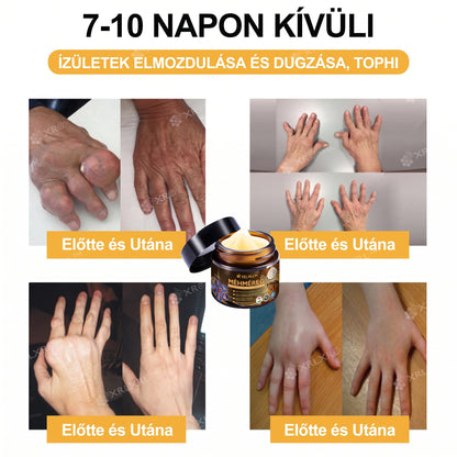 Hivatalos bolt: XRLXRL® Méhméreg Azonnali Ultra Erős Fájdalomcsillapító Krém - (🧑‍⚕️Enyhíti a fájdalmat ízületi gyulladás, izomfájdalom, hátfájás, térdek, hát, vállak, csípők, csuklók, kezek esetén)