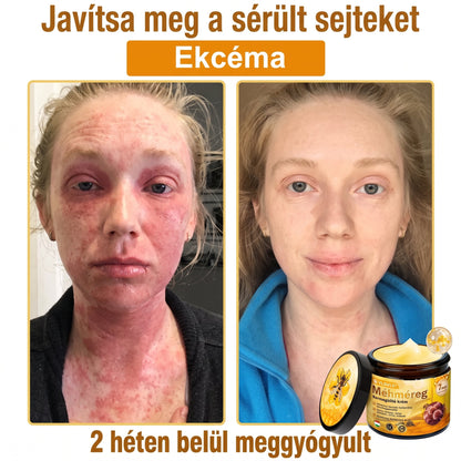 🔹 𝑽𝙇𝙎𝑽𝑳𝑺® Méhméreg Bőr Helyreállító Krém (🎉🎉CE Tanúsítvány)